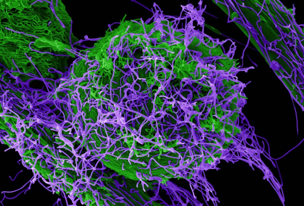 Colourized microscopic imaging of the Ebola virus, representing Ebola-related travel restrictions in Canada in 2026.