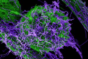 Colourized microscopic imaging of the Ebola virus, representing Ebola-related travel restrictions in Canada in 2026.